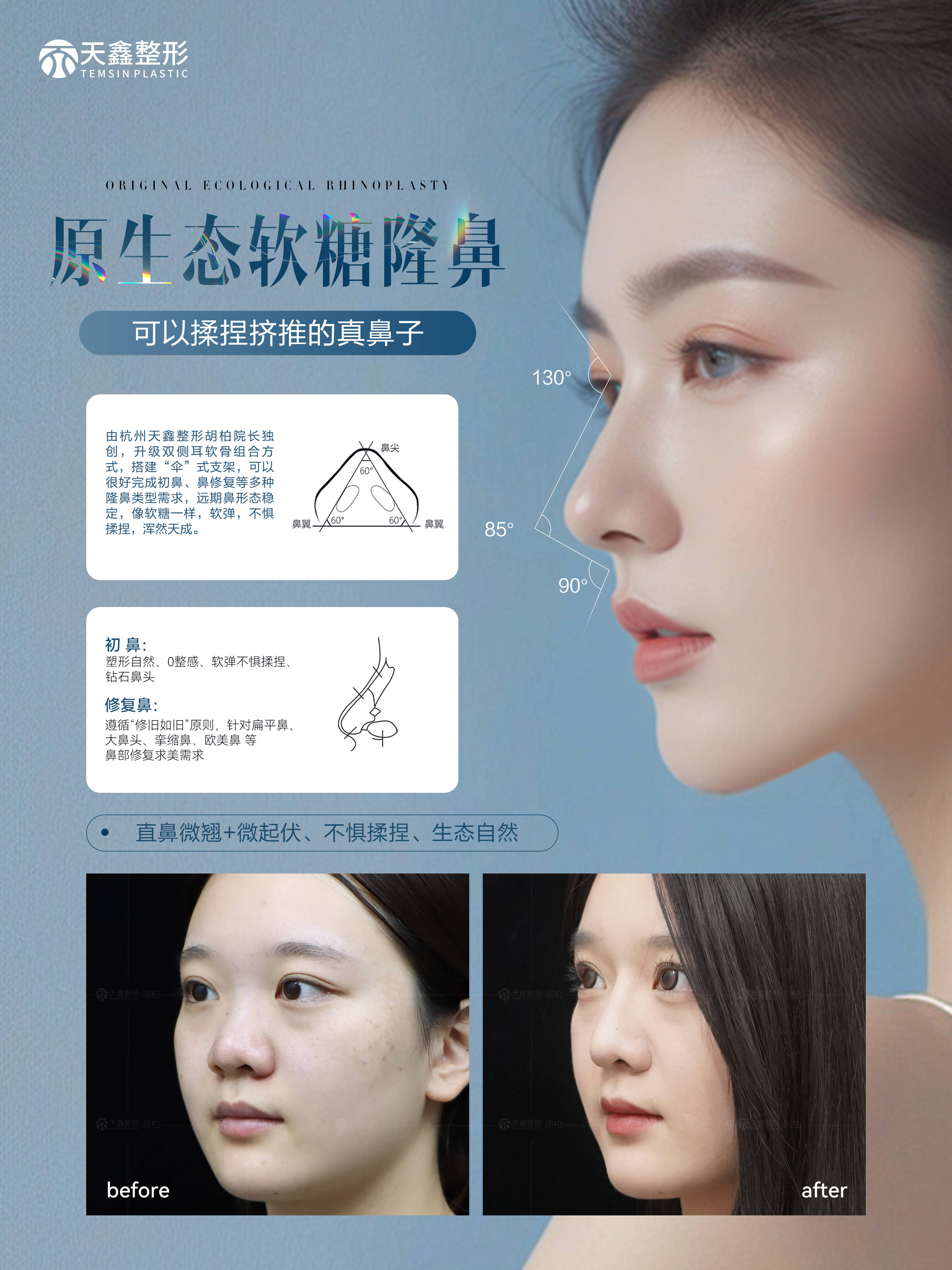 【美,值得期待!】杭州天鑫整形胡柏院长以匠心精神雕琢未来之美